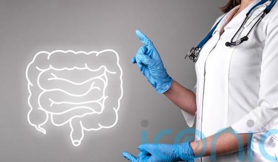 What can I expect during bowel cancer screening &ndash; and am I eligible?