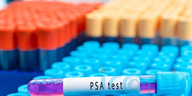 Trial for prostate cancer treatment with fewer side-effects launches in UK