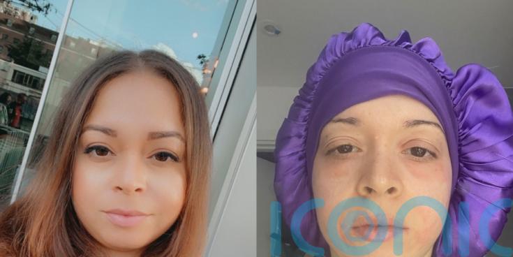 Mother believes she has &lsquo;overgrowth&rsquo; of skin&rsquo;s naturally occurring mites and feels them &lsquo;scurrying over her 24/7&rsquo;