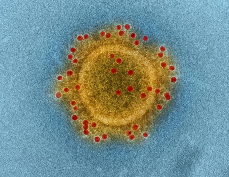Covid-19 cases continue sharp rise as daily numbers released