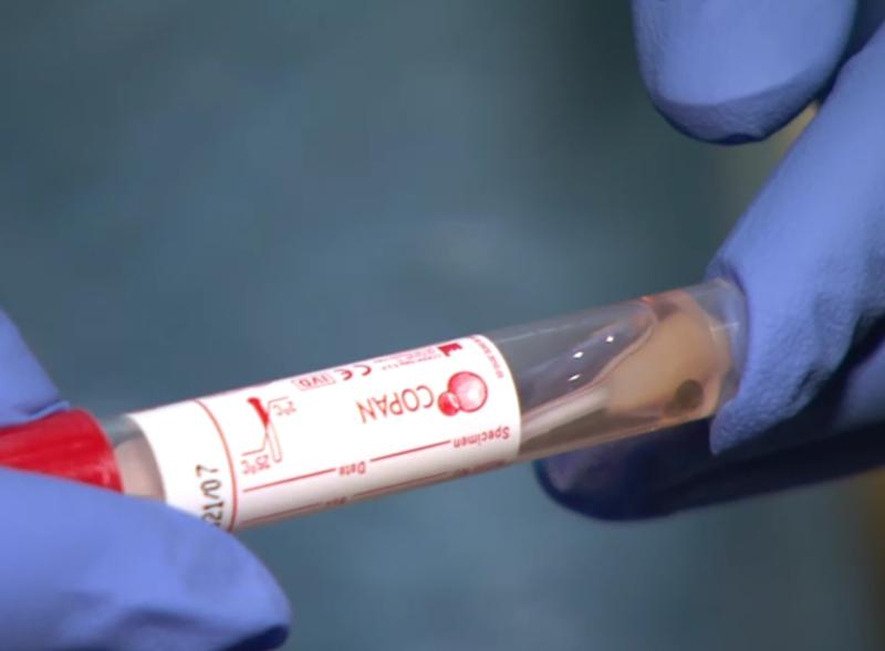 Tullamore Hospital reports increasing levels of Covid-19 amid alert to patients