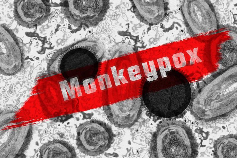 First cases of Monkeypox confirmed in Mid West