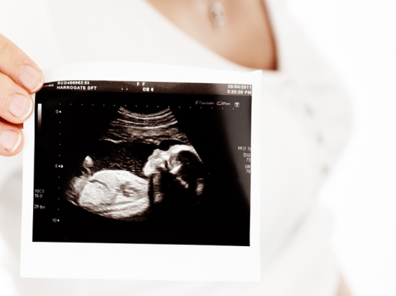 Waterford couples with infertility can soon avail of public IVF as start date revealed