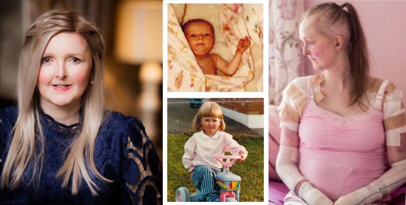 Laois EB patient Emma Fogarty has one wish for her 40th birthday