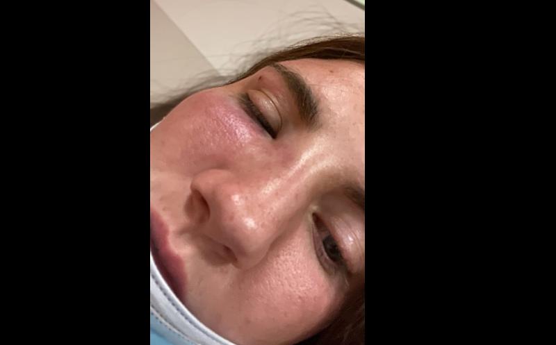 EXCLUSIVE: First photo of horrific injuries sustained by young woman viciously assaulted by soldier in Limerick