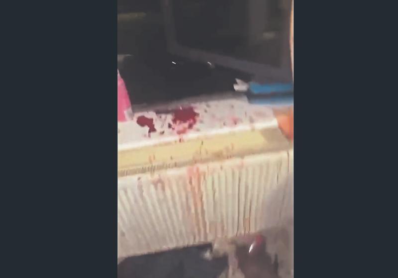 'Bloodbath' as two men hospitalised with slash injuries in aggravated burglaries in Limerick