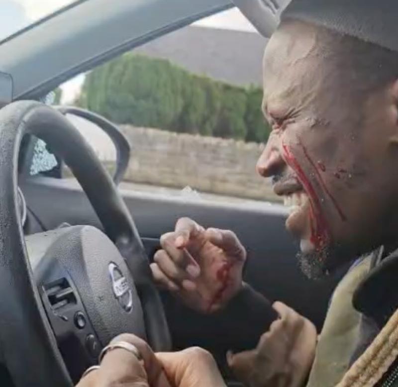 &lsquo;The day the world went dark&rsquo;: Dancer who performed in Longford left blind after man smashed car window