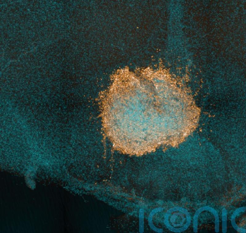 White blood cells of immune system can fight Omicron, says new study