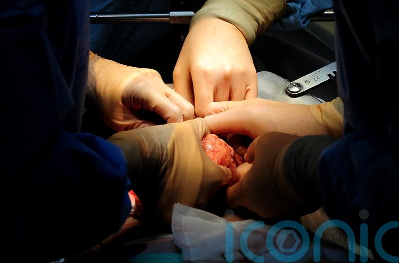 Female patients more likely to die if surgeon is male, study finds