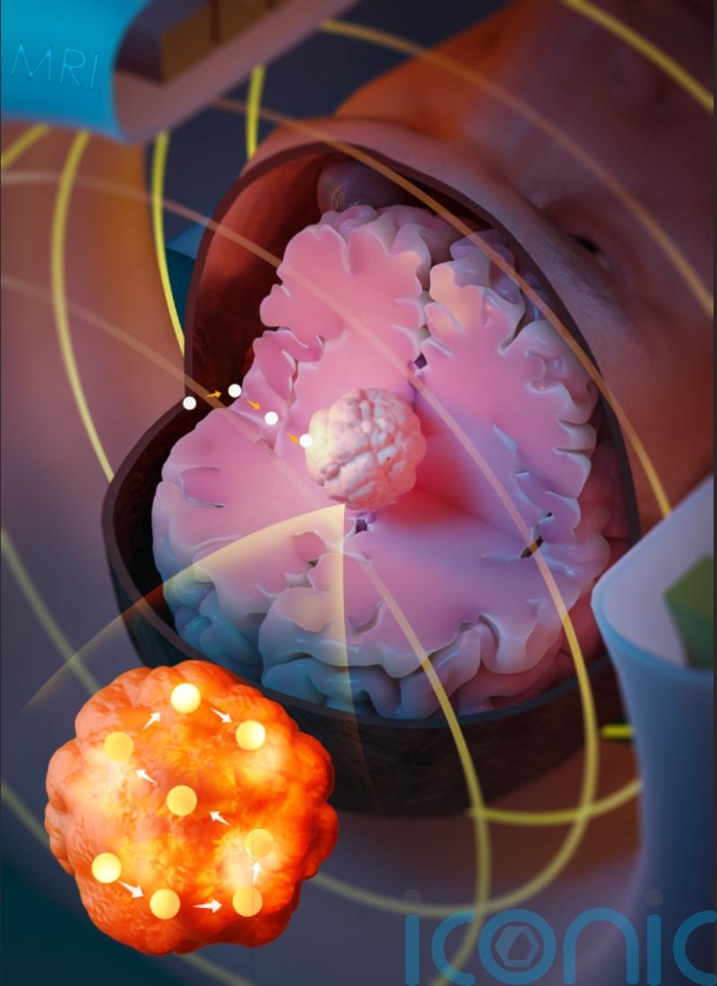 Magnetic seeds used to heat and kill tumours could help survival – study