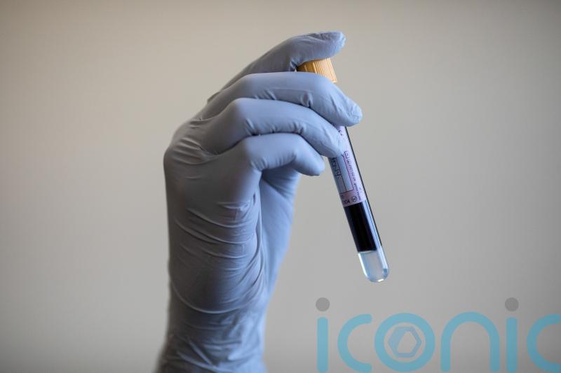 Health board bids to trace patient after HIV detected in blood sample