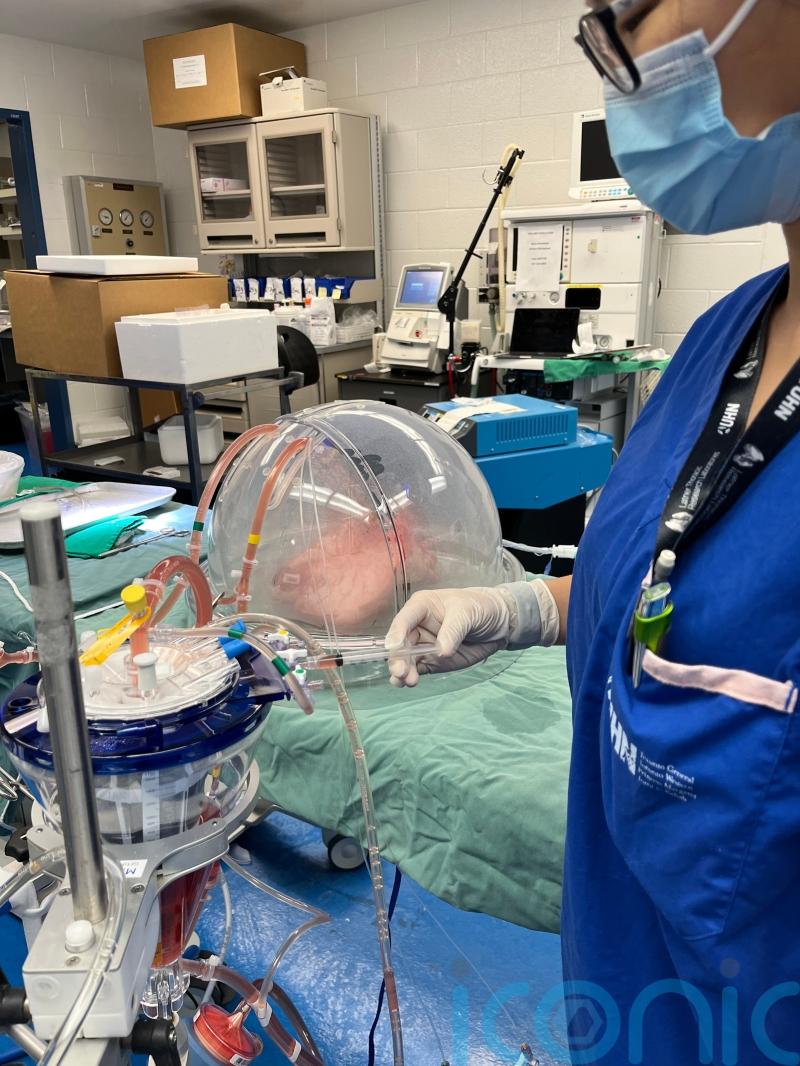 Researchers convert lungs for transplant to universal blood type