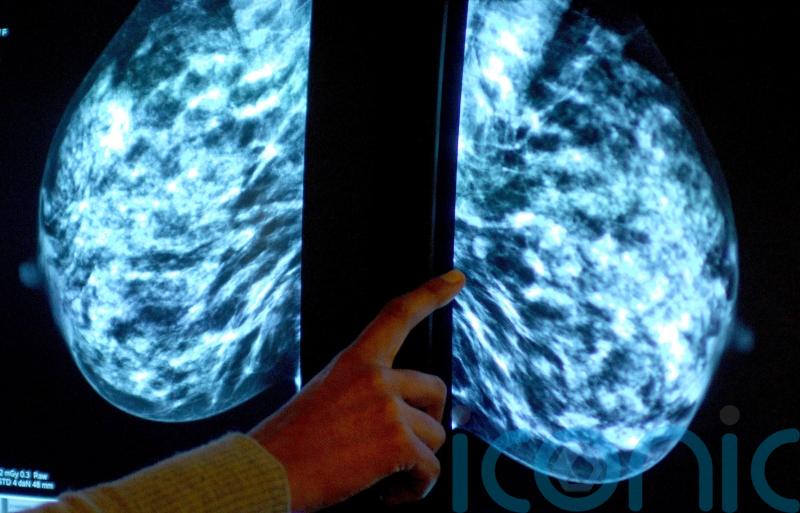 Cancers services in Northern Ireland facing ‘massive perfect storm’, MLAs warned