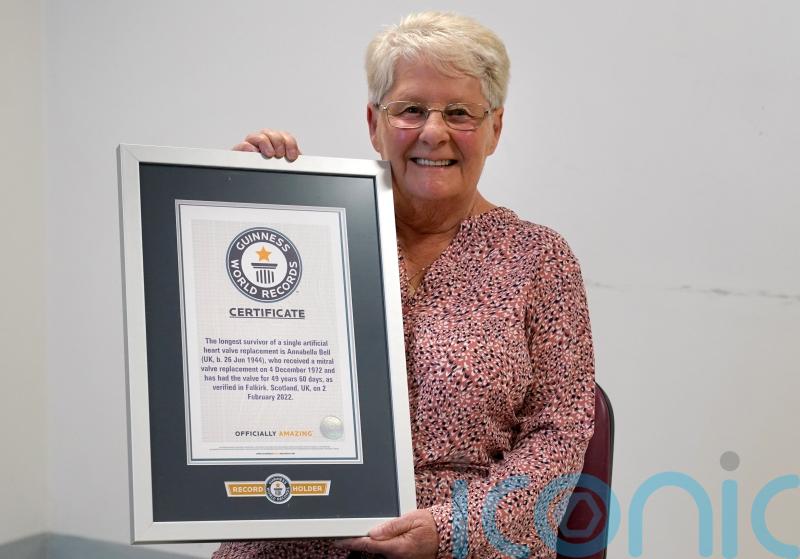 Record-breaking heart op woman feels ‘incredibly lucky’ almost 50 years on