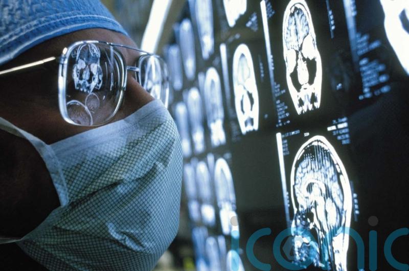 Most Scots not getting enough sleep as organisation urges focus on brain health