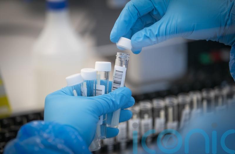 Scotland’s Covid cases could peak in next couple of weeks – expert