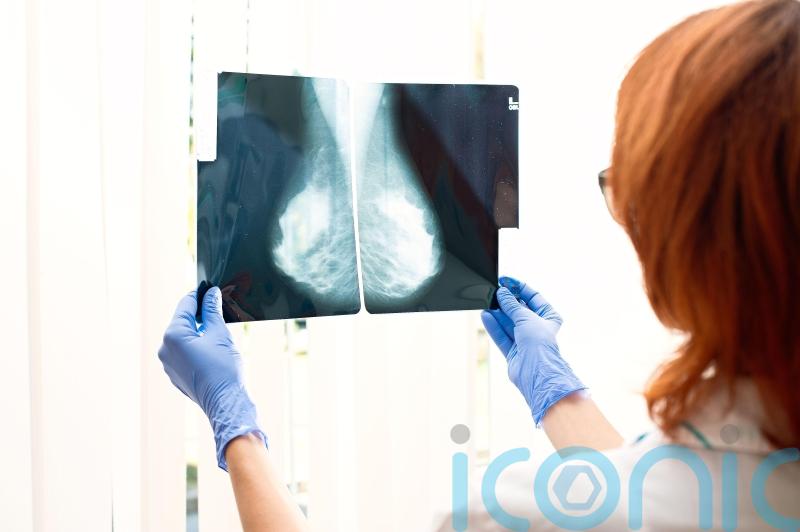 Drug slashes risk of death for women with high-risk breast cancer by 32%