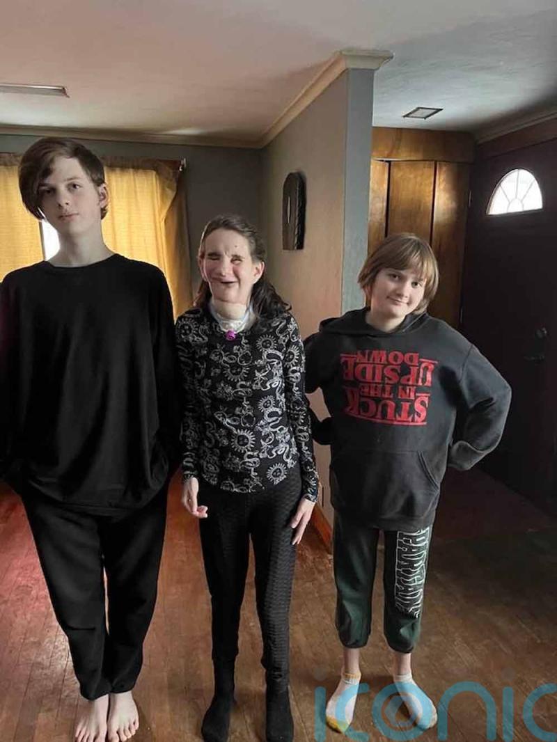 Ex-high school beauty queen’s life with her husband and children is beyond her wildest dreams despite being born blind and with “half a face”