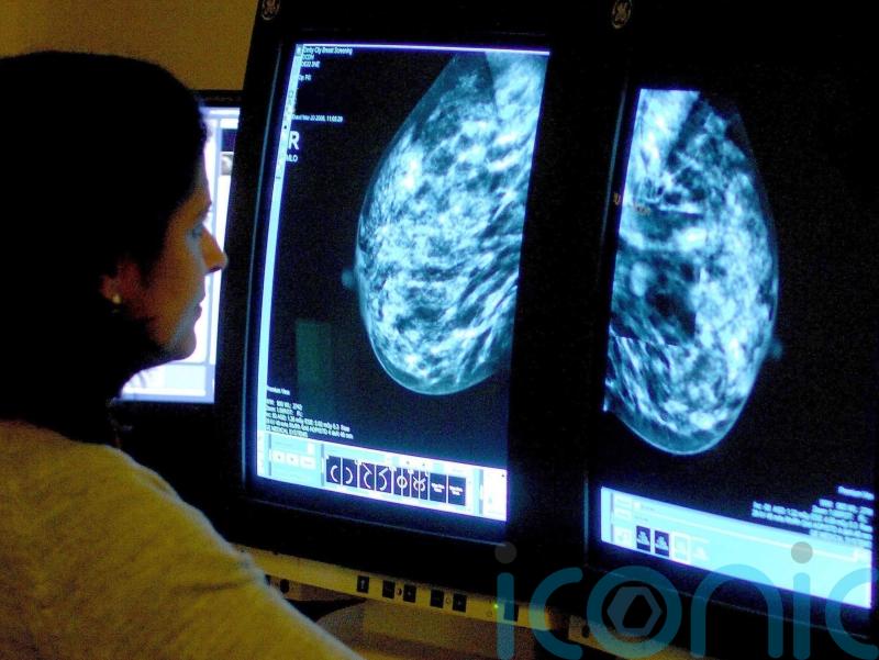 Breast cancer cases may have been missed because of pandemic, figures suggest