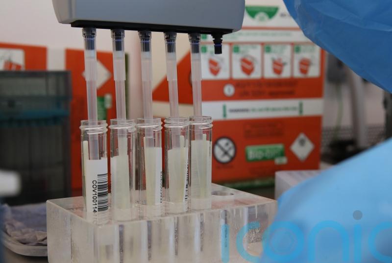 Number of people to die in Scotland after positive Covid test passes 12,000
