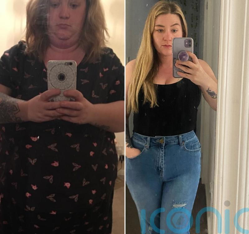Mum who “looks like a bear” at 20st 5lb feels sexy after losing 9st 2lb and having £6k “mummy makeover” and implants for “loopy” breasts