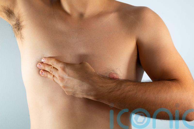 Everything you need to know about male breast cancer, as a new infertility link is discovered