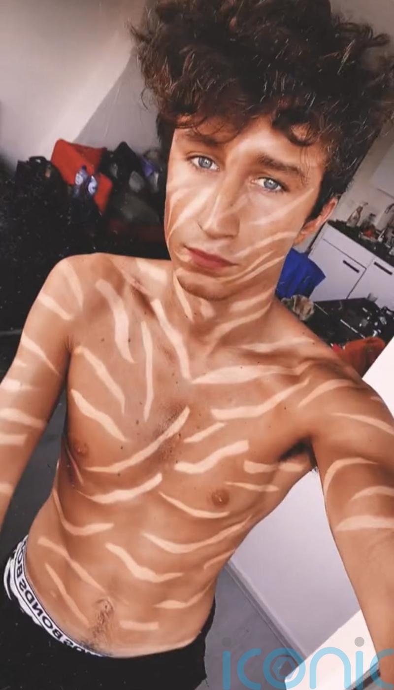 VIDEO: Struggling musician covers himself in an incredible zebra tan – attracting 20 million views on TikTok and attention from hundreds of women