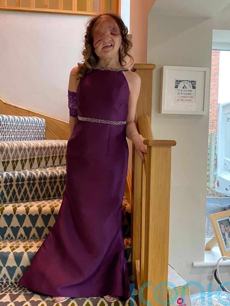 Remarkable 18 year old with a genetic condition that causes “droopy” tumours is determined to have her own house, job, family and find love