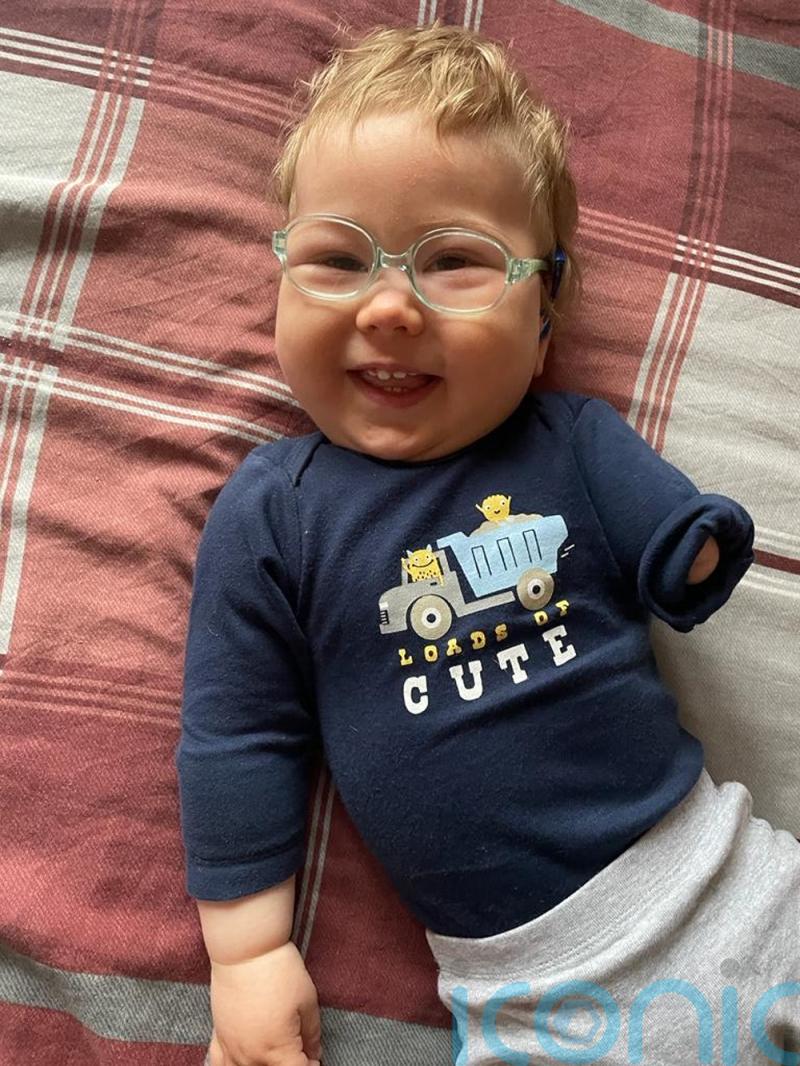 Baby’s arm was amputated at 10 days old after he suffered blood clots in the womb but now he is a happy tot celebrating his first birthday
