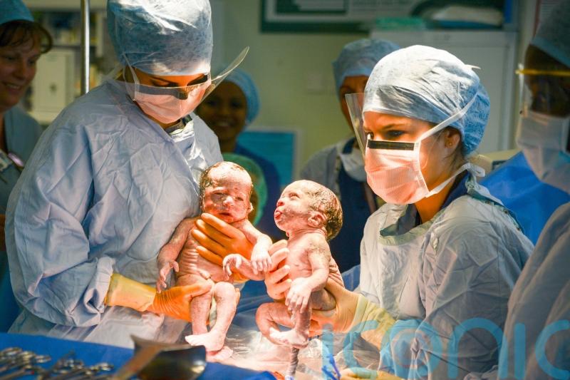Pre-birth steroids could reduce risk of death in premature twins, study suggests