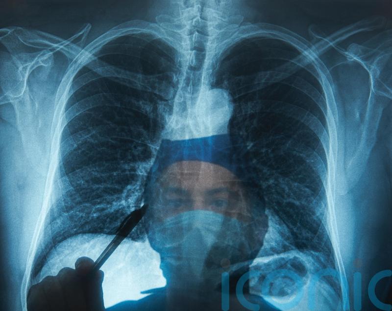 NHS campaign urges people not to ignore lung cancer symptoms