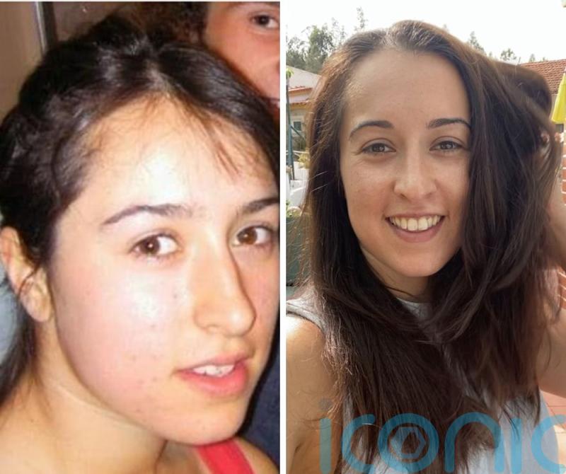 Businesswoman who yanks her own hair out for 18 years following dad’s death in jail when she was nine recovers and launches haircare brand