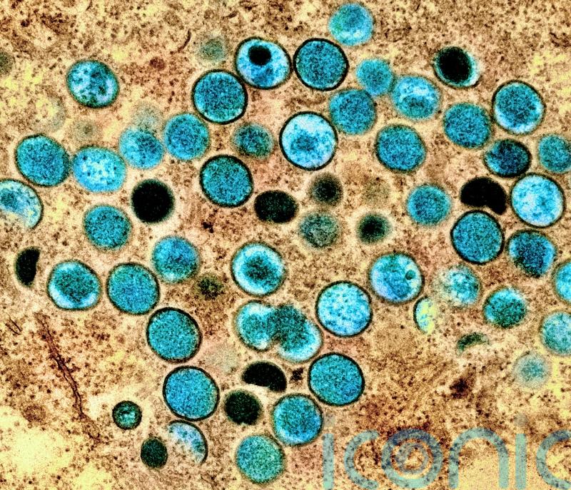 Vaccination advice for groups most at risk of monkeypox in Waterford to be issued soon
