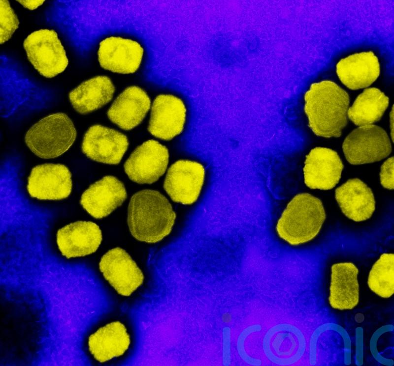 Monkeypox cases increase by two in Scotland, figures show