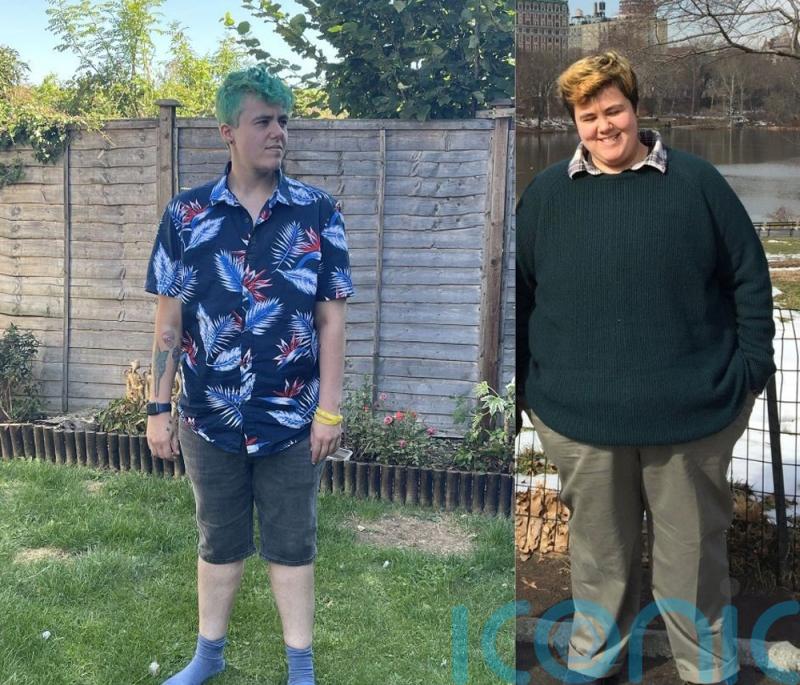 A 25st 5lb trans chef who overate thinking he was “a crackpot” drops to 13st 5lb post bariatric surgery and needs £10K to remove DD breasts