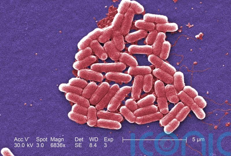E. coli outbreak at East Lothian nursery leads to 28 cases