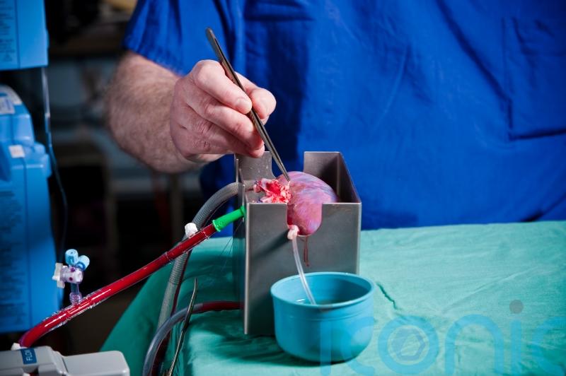Transplant hope for minorities as researchers alter donor kidney blood type
