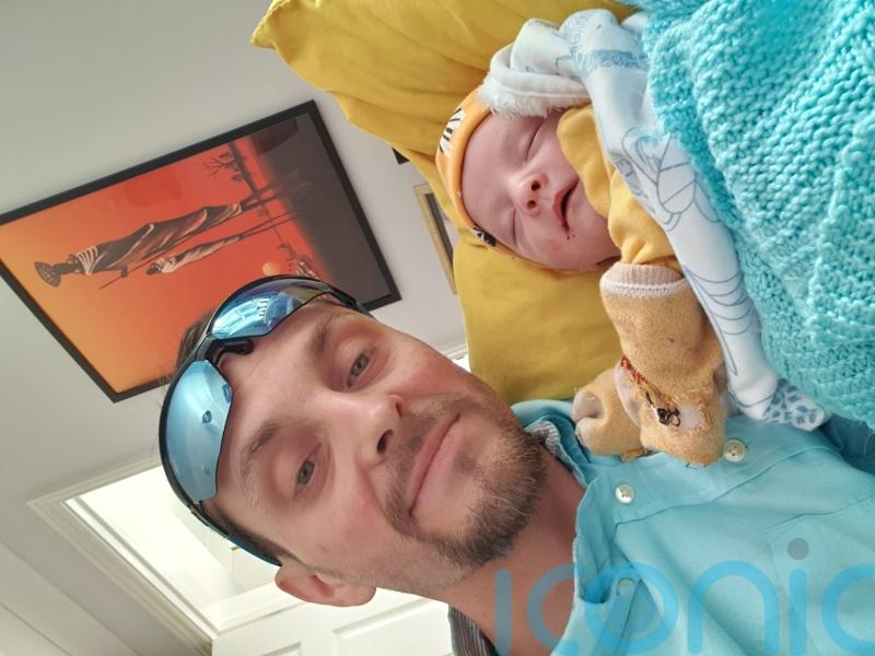 Baby’s ‘Freddy Krueger’ blisters mean his parents are afraid to cuddle him for fear of deadly infections