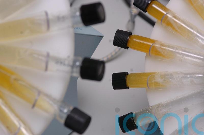 Not enough people offered kidney disease test, research finds