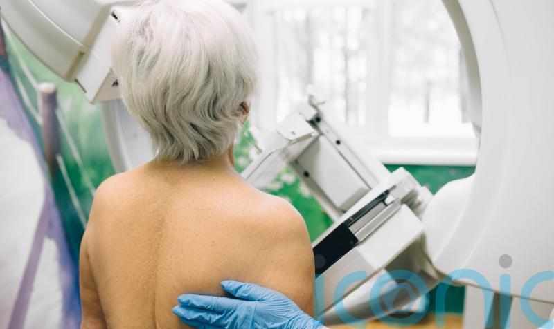 Cancer screening ‘must not get lost’ under other NHS pressures