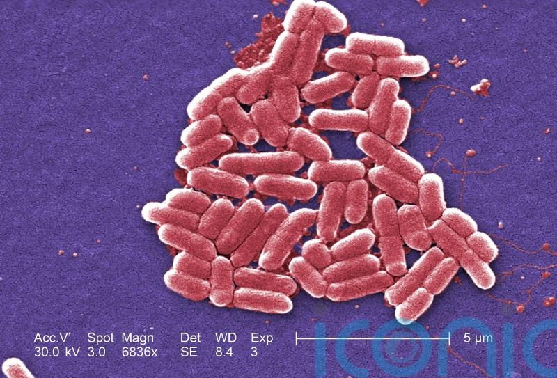 Class at Scottish primary school told to stay at home amid E.coli outbreak
