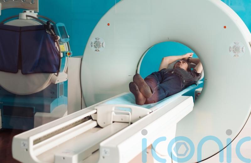 Study highlights concern over ‘missed’ pancreatic cancer in scans