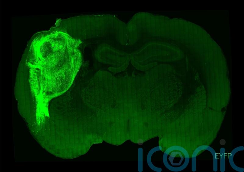 Human tissue transplanted into rats ‘could advance brain disorders research’