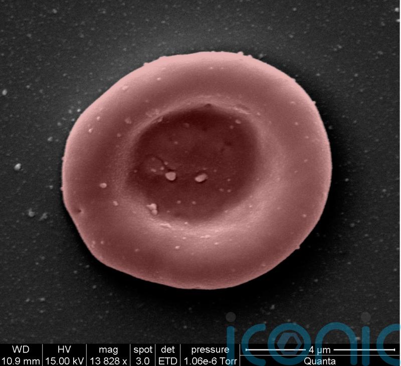 ‘Lab-grown red blood cells transfused in to person in a world first’