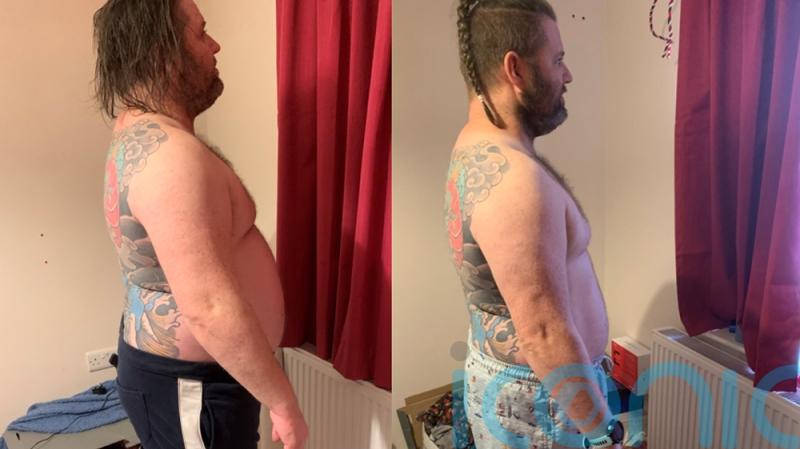 Dad of five who once struggled to put socks on due to chronic condition can now do the school run again after losing 7st