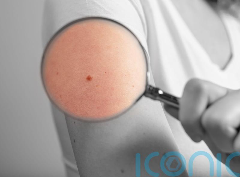 Skin cancer care review urges consistency in treatment