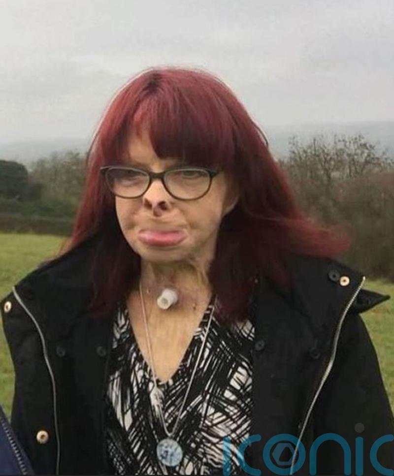 Jackie Kirk’s children ‘grateful’ for every day she lived after attack