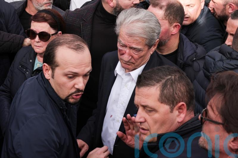 Albanian opposition leader attacked during anti-government protest