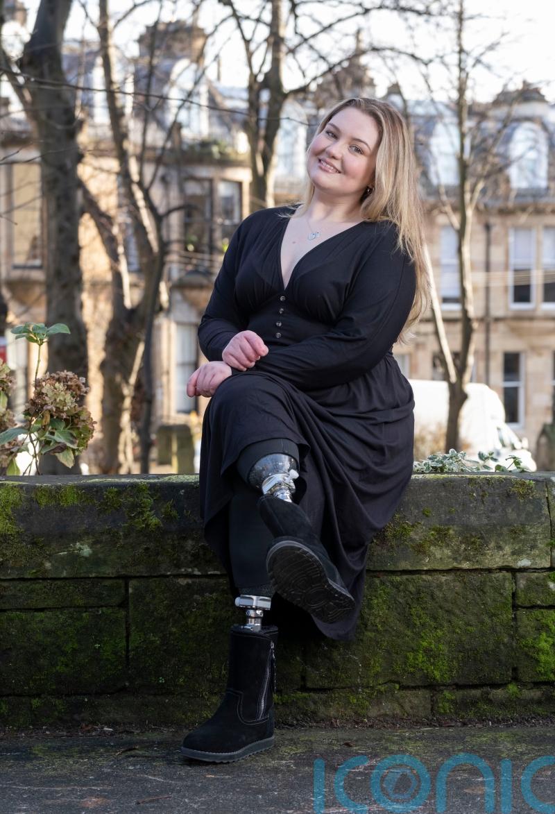 Woman’s life transformed after living kidney donation by mother and stranger
