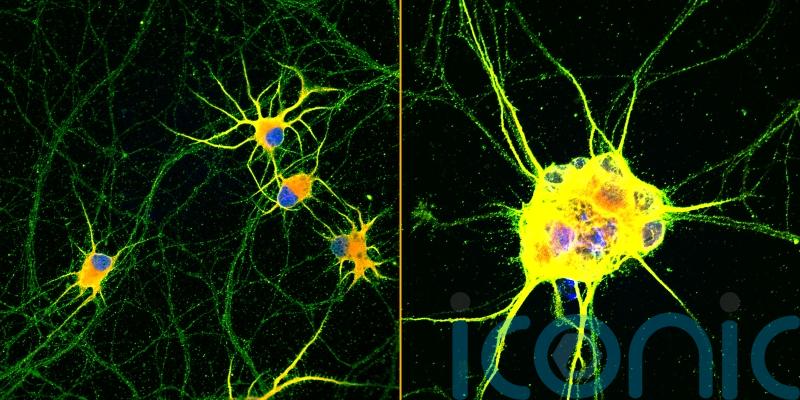 Lab grown nerve cells ‘holds promise for neurodegenerative disease’